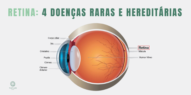 Doenças da Retina